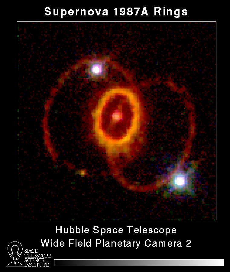 The Mysterious Rings of Supernova 1987a