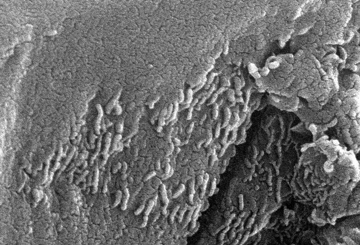 Early Microscopic Life on Mars?