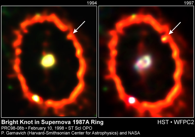 Shocked by Supernova 1987a